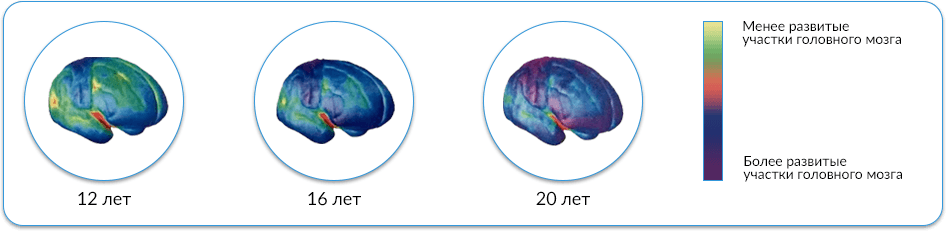brains.png